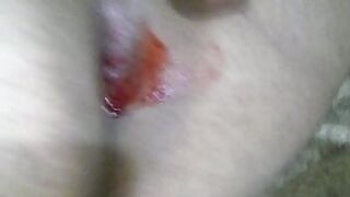 Гей ломая задницу с вибратором - порно видео